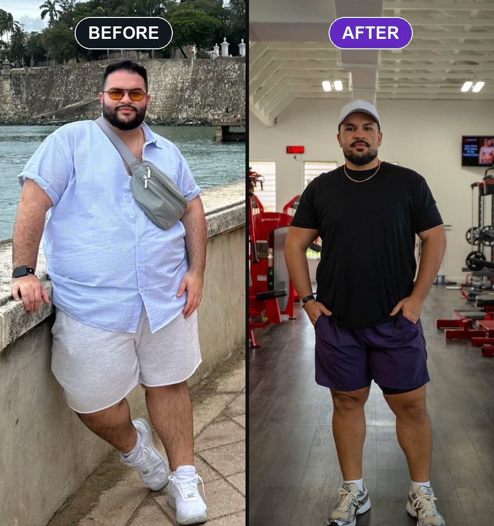 Carlos Velez before and after